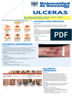 ULCERAS