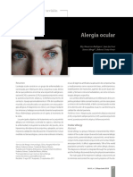 Alergia Ocular: Artículo de Revisión