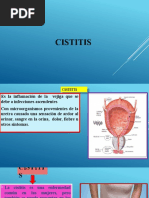 Cictitis Diapositivas