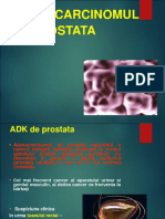 Adenocarcinomul de Prostata PDF