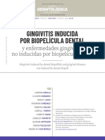 Articulo de Gingivitis