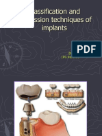 Classification and Impression Techniques of Implants