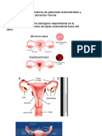 Endometriosis EXP