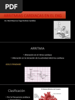 Arritmias Cardiacas en El Ekg