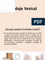 Sondaje Vesical