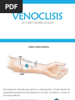 VENOCLISIS