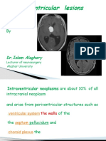 Ventricular Lesions