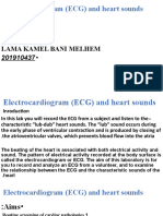 Experiment 6:: Electrocardiogram (ECG) and Heart Sounds