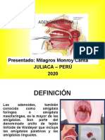 ADENOIDECTOMIA