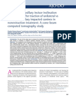 Changes in Maxillary Incisor Inclination and Position After Traction of Unilateral Vs Bilateral Maxillary Impacted Canines in Nonextraction Treatment: A Cone-Beam Computed Tomography Study