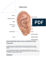 Auriculoterapia Láser para La Parálisis Facial