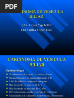 Carcinoma de Vesicula Biliar