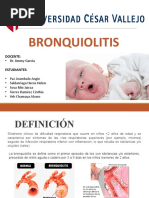 Bronquiolitis Final