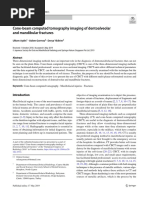 Cone Beam Computed Tomography Imaging of Dentoalveolar and Mandibular Fractures