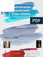 Instrumento Fracturado - Caso Clínico.