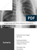 Imagenología Del Aparato Respiratorio