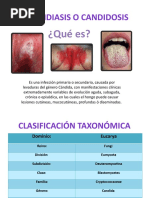 Candidiasis o Candidosis