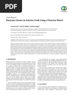 Case Report: Diastema Closure in Anterior Teeth Using A Posterior Matrix