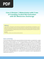 Class II Division 1 Malocclusion With 5 MM of Crowding Treated Non-Extraction With IZC Miniscrews Anchorage