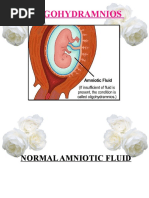 OLIGOHYDRAMNIOS