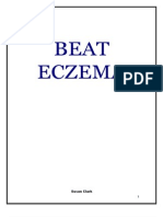 Beat Eczema: Susan Clark