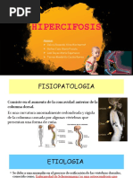 HIPERCIFOSIS