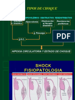 3 - Tipos de Shock