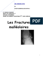 Fractures Bi-Malleolaires