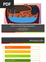 Ascitis y Su Abordaje Diagnostico (Juan David Velez)