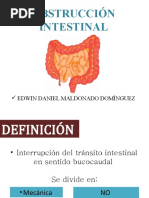 Obstruccion Intestinal