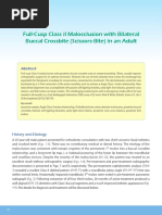 2 Full-Cusp Class II Malocclusion With Bilateral