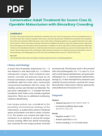 Conservative Adult Treatment For Severe Class III