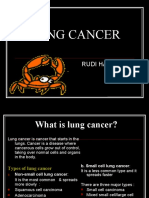 Lung Cancer