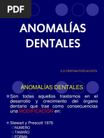 Anomalias Dentales