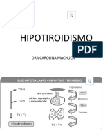 Hipotiroidismo Udo