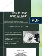 How To Read Brain CT Scan