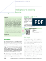 Vertex Occlusal Radiography in Localizing Unerupte