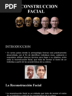 Reconstruccion Facial