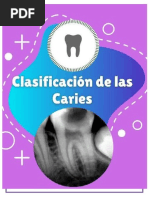 Informe Clasificacion de Caries