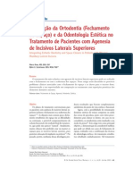 Integração Da Ortodontia Fechamento de Espaço e Da Dontologia Estética No Tratamento de Pacientes C Agenesia de Incisivos Lateral