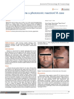 Is Dermal Melasma A Phototoxic Reaction? A Case: Abbrevations