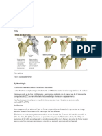 Fractura Cabeza Del Femur