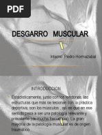 Desgarro Muscular