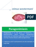 Paragonimus Westermani