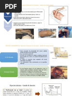 Fractura Olecranon, Luxación de Codo