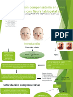 Articulación Compensatoria en Niños Chilenos Con Fisura Labiopalatina
