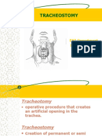 Tracheostomy: ENT Department DMC & Hospital Ludhiana Punjab