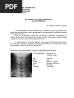 Anatomiìa Radioloìgica Raquis Vertebral