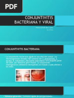 Conjuntivitis Bacteriana y Viral