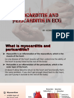  Myocarditis and Pericarditis in ECG